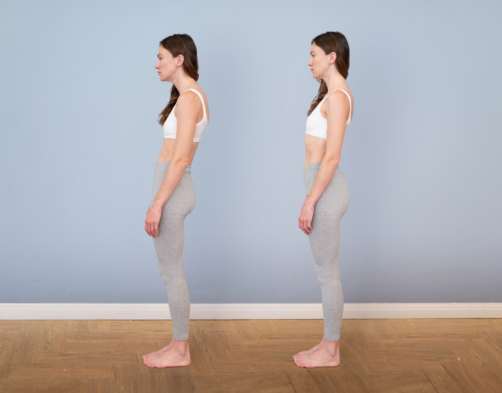 Fix Diastasis and Prolapse- why posture matters